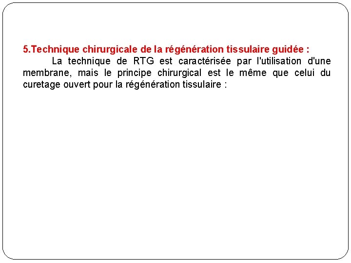 5. Technique chirurgicale de la régénération tissulaire guidée : La technique de RTG est