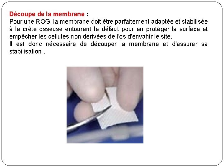 Découpe de la membrane : Pour une ROG, la membrane doit être parfaitement adaptée