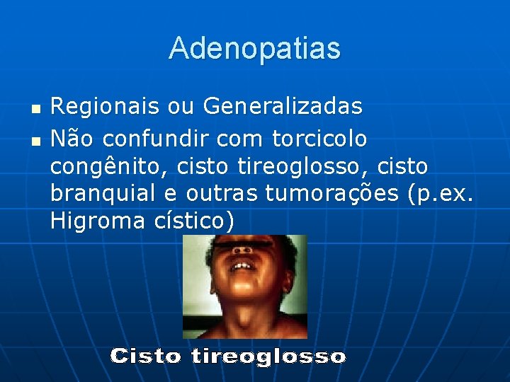 Adenopatias n n Regionais ou Generalizadas Não confundir com torcicolo congênito, cisto tireoglosso, cisto