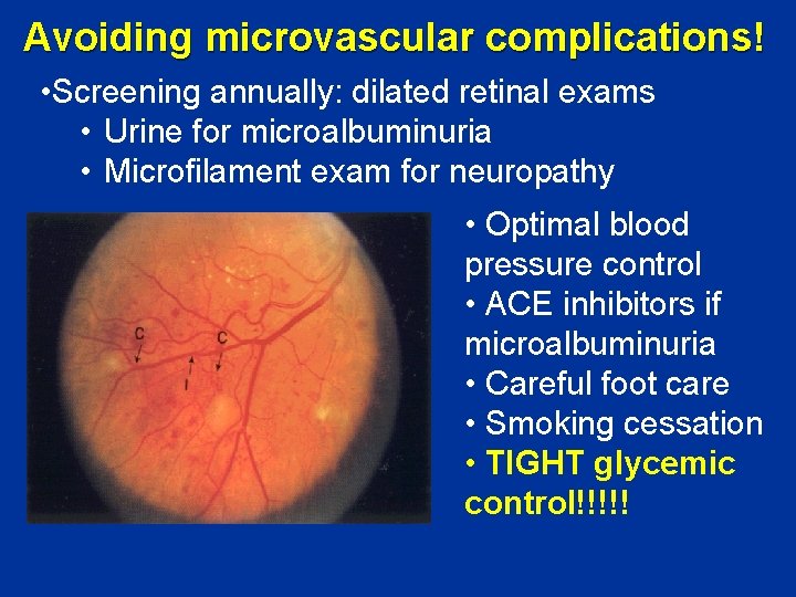 Avoiding microvascular complications! • Screening annually: dilated retinal exams • Urine for microalbuminuria •