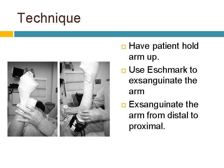 Technique Have patient hold arm up. Use Eschmark to exsanguinate the arm Exsanguinate the