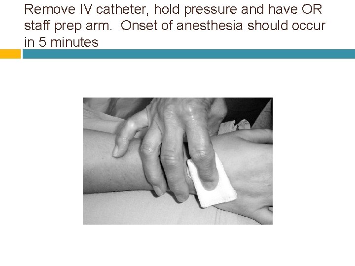 Remove IV catheter, hold pressure and have OR staff prep arm. Onset of anesthesia