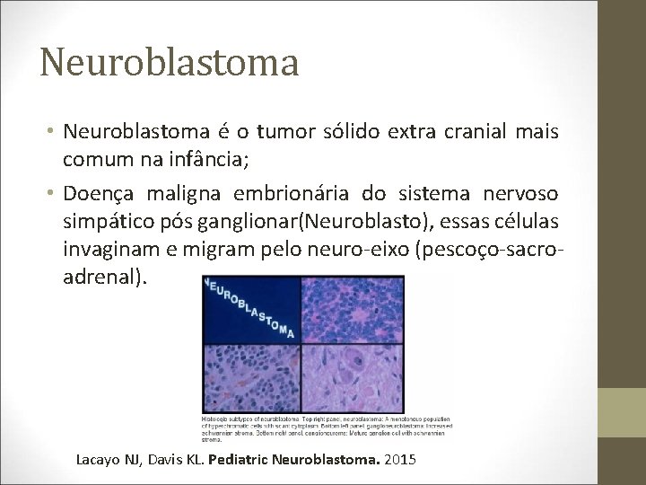 Neuroblastoma • Neuroblastoma é o tumor sólido extra cranial mais comum na infância; •