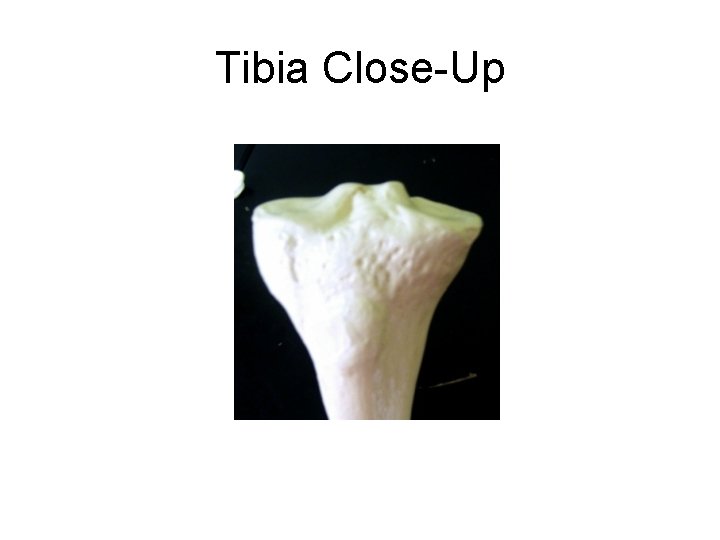 Tibia Close-Up 