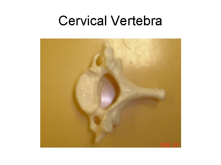 Cervical Vertebra 