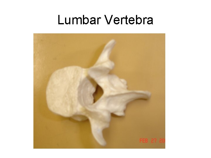 Lumbar Vertebra 