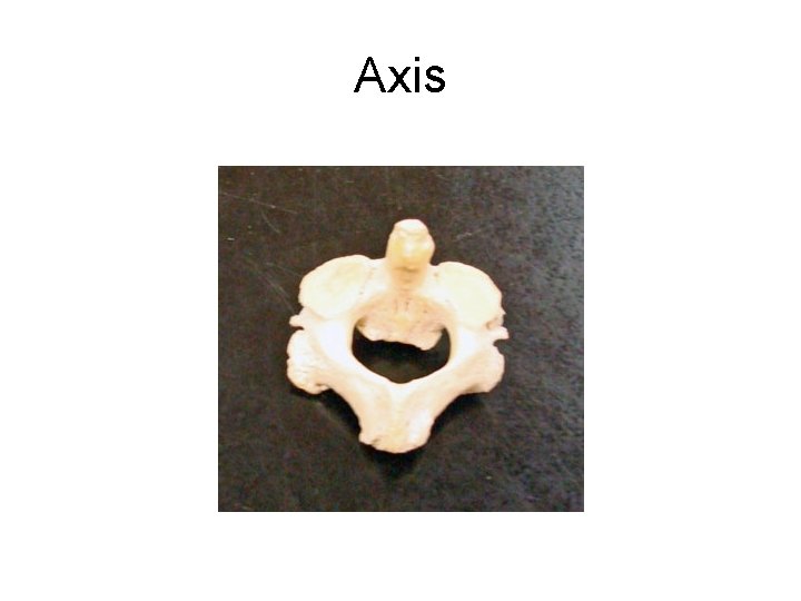 Axis 