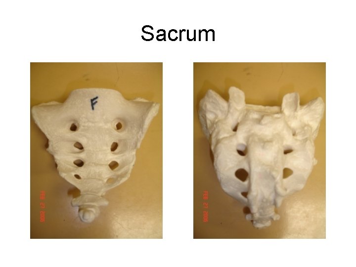 Sacrum Anterior Sacrum Posterior Sacrum 
