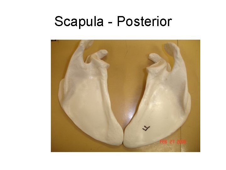 Scapula - Posterior Right Scapula Left Scapula 