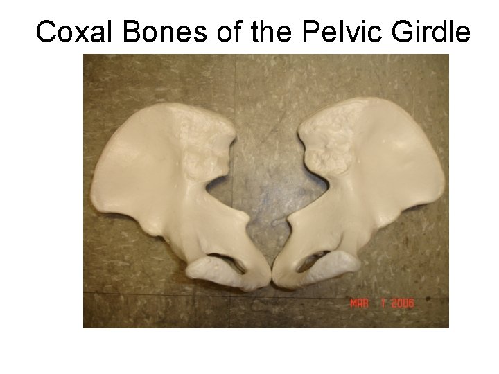 Coxal Bones of the Pelvic Girdle Right Left 