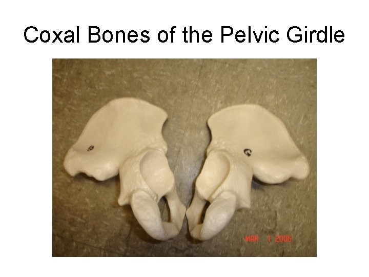 Coxal Bones of the Pelvic Girdle 