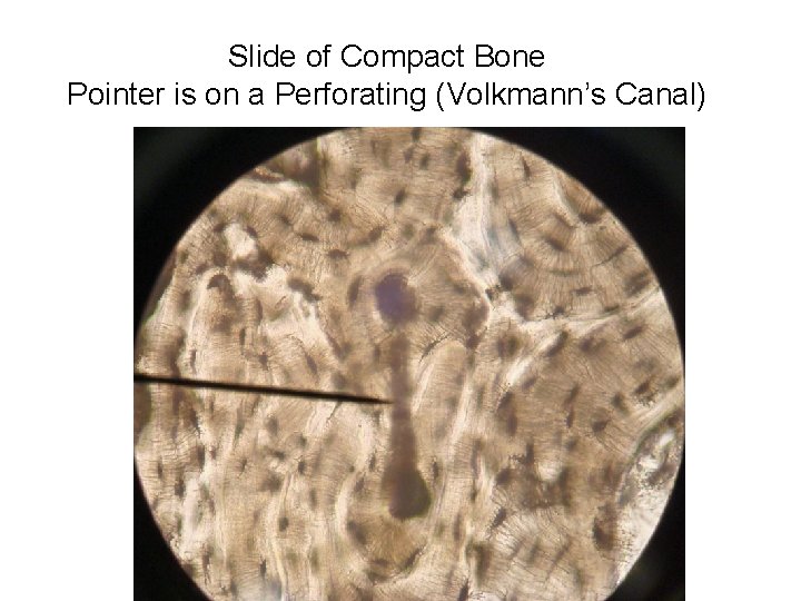 Slide of Compact Bone Pointer is on a Perforating (Volkmann’s Canal) 