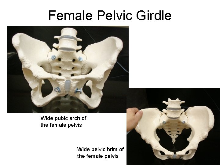 Female Pelvic Girdle Wide pubic arch of the female pelvis Wide pelvic brim of