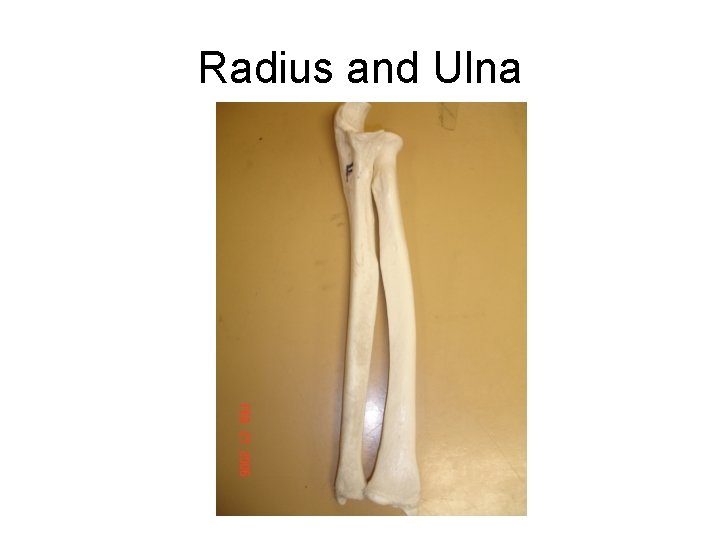 Radius and Ulna 
