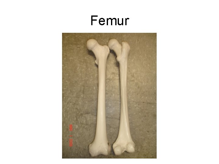 Femur Left Anterior Femur Right Posterior Femur 