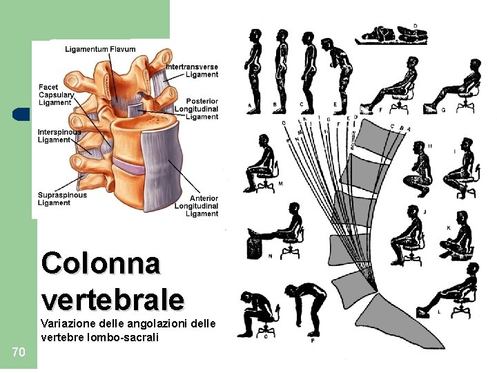  Colonna vertebrale Variazione delle angolazioni delle vertebre lombo-sacrali 70 