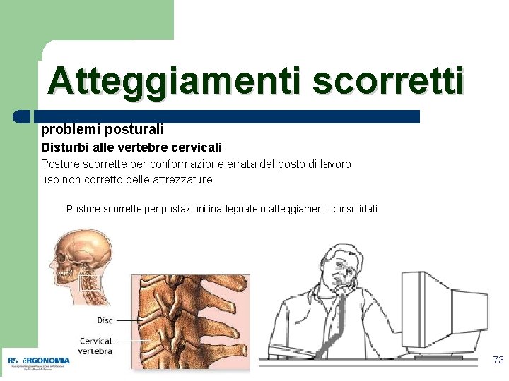 Atteggiamenti scorretti problemi posturali Disturbi alle vertebre cervicali Posture scorrette per conformazione errata del