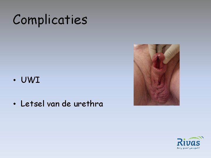 Complicaties • UWI • Letsel van de urethra 
