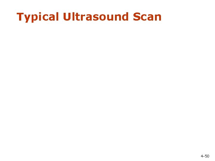 Typical Ultrasound Scan 4 -50 