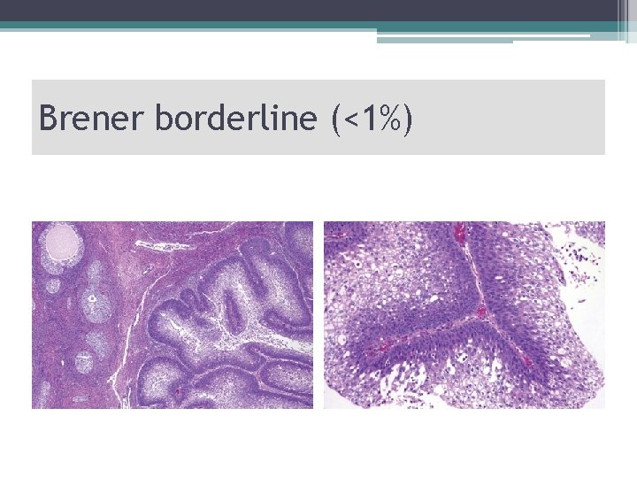 Brener borderline (<1%) 