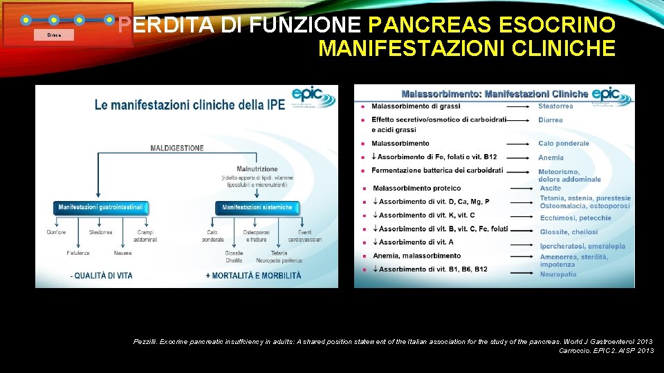 Clnica PERDITA DI FUNZIONE PANCREAS ESOCRINO MANIFESTAZIONI CLINICHE Pezzilli. Exocrine pancreatic insuffciency in adults: