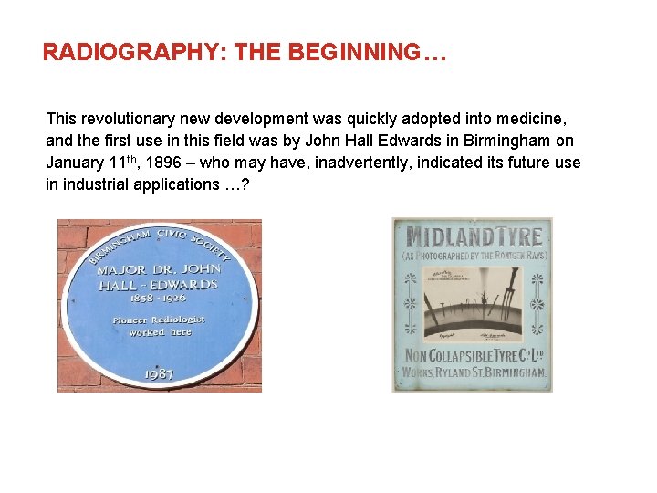 RADIOGRAPHY: THE BEGINNING… This revolutionary new development was quickly adopted into medicine, and the