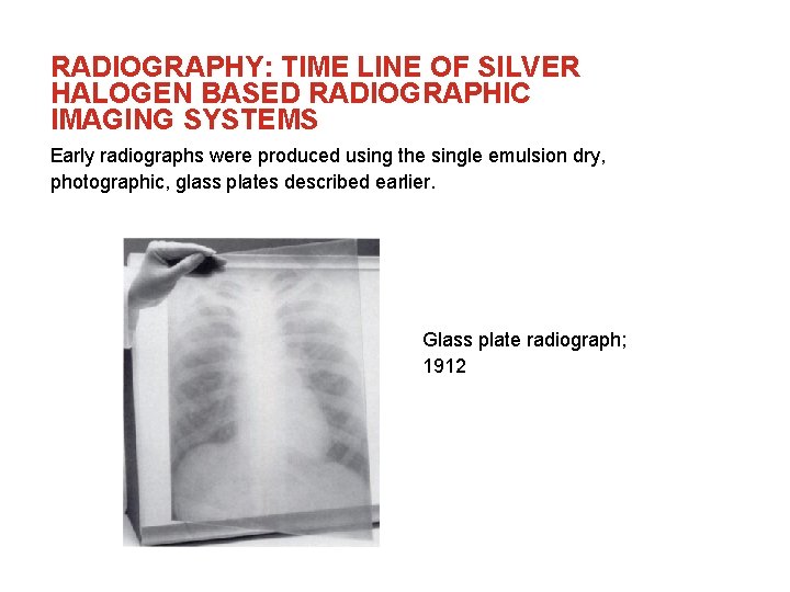 RADIOGRAPHY: TIME LINE OF SILVER HALOGEN BASED RADIOGRAPHIC IMAGING SYSTEMS Early radiographs were produced