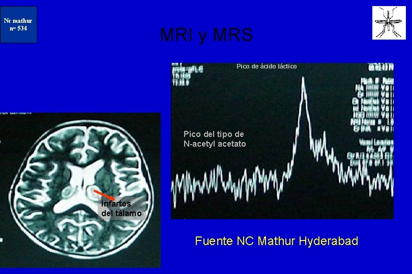 N=234 Nc mathur n= 534 MRI y MRS Pico de ácido láctico Pico del