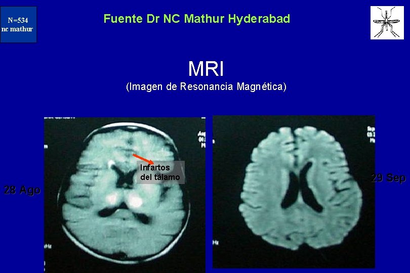 N=234 N=534 nc mathur Fuente Dr NC Mathur Hyderabad MRI (Imagen de Resonancia Magnética)