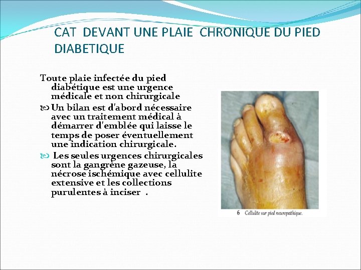CAT DEVANT UNE PLAIE CHRONIQUE DU PIED DIABETIQUE Toute plaie infectée du pied diabétique