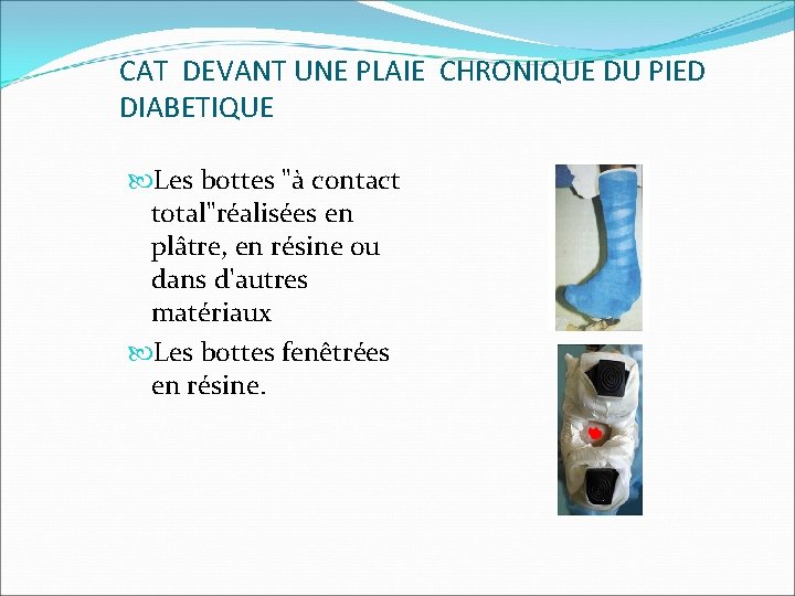 CAT DEVANT UNE PLAIE CHRONIQUE DU PIED DIABETIQUE Les bottes "à contact total"réalisées en