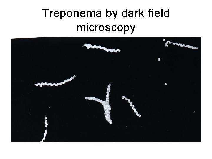 Treponema by dark-field microscopy 