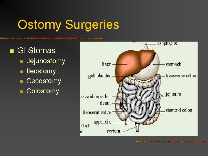 Ostomy Surgeries n GI Stomas n n Jejunostomy Ileostomy Cecostomy Colostomy 