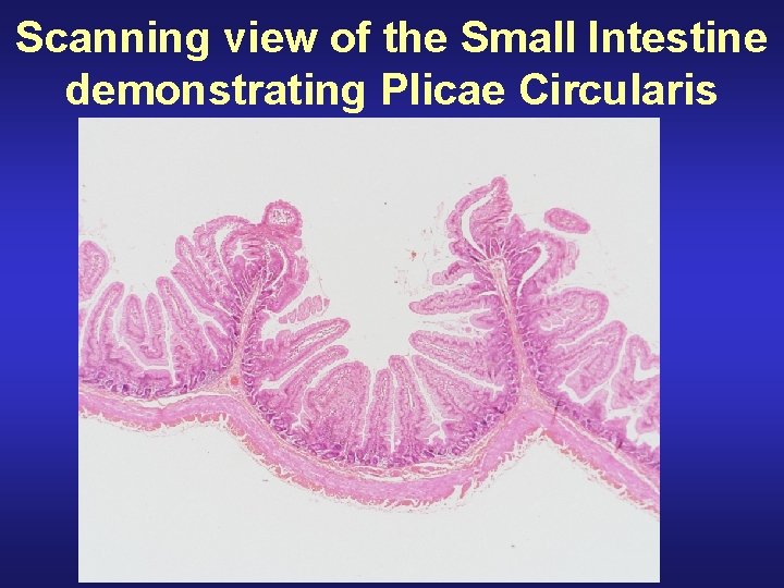 Scanning view of the Small Intestine demonstrating Plicae Circularis 