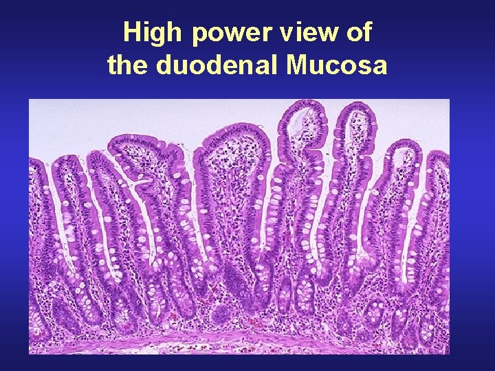 High power view of the duodenal Mucosa 