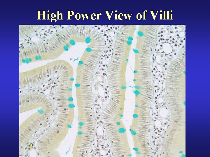 High Power View of Villi 