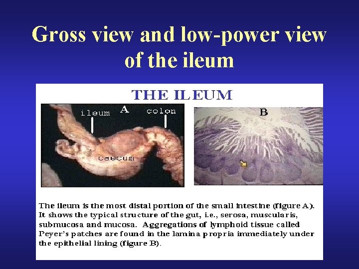 Gross view and low-power view of the ileum 