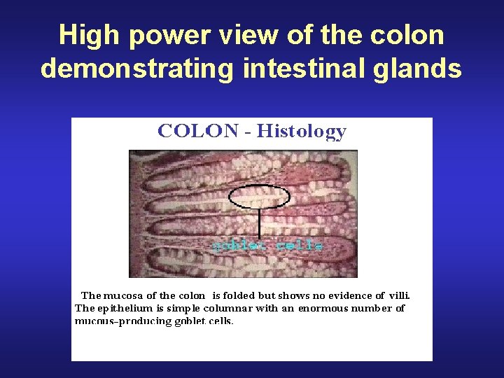 High power view of the colon demonstrating intestinal glands 