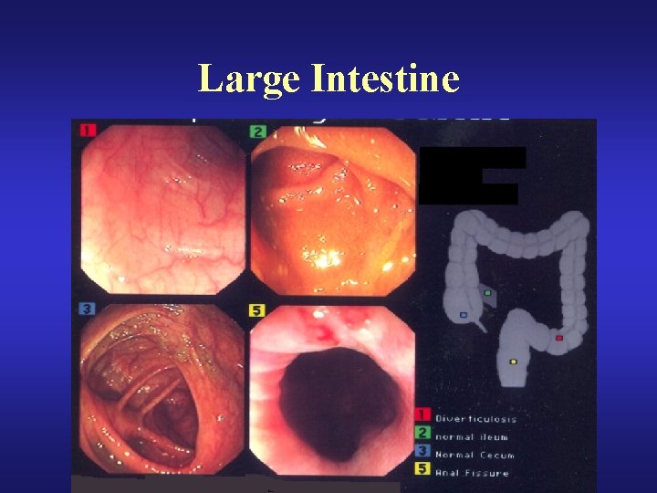 Large Intestine 