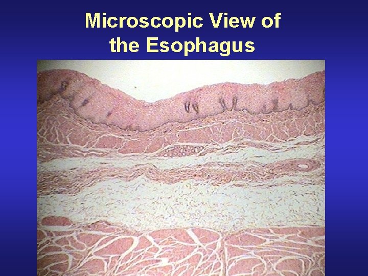 Microscopic View of the Esophagus 