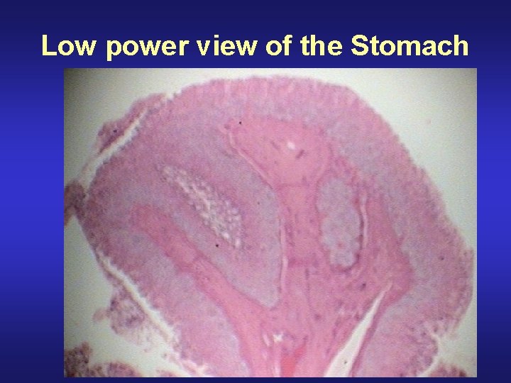 Low power view of the Stomach 