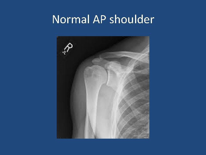 Normal AP shoulder 