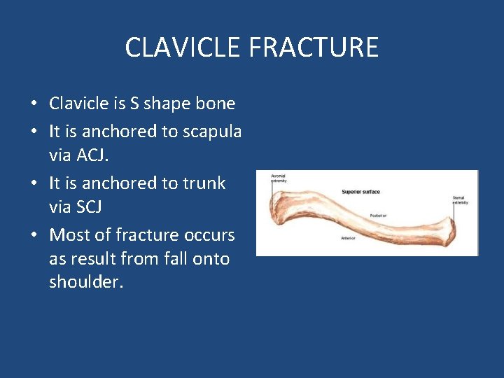 CLAVICLE FRACTURE • Clavicle is S shape bone • It is anchored to scapula