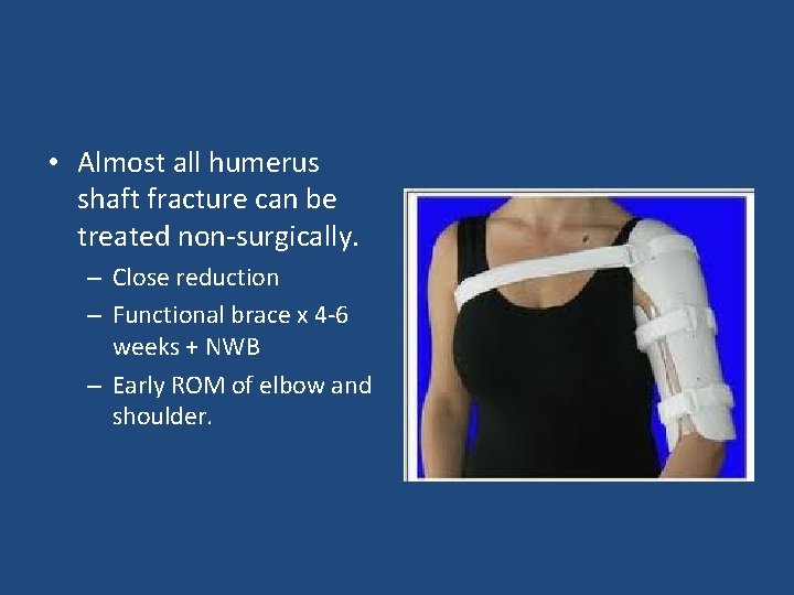  • Almost all humerus shaft fracture can be treated non-surgically. – Close reduction