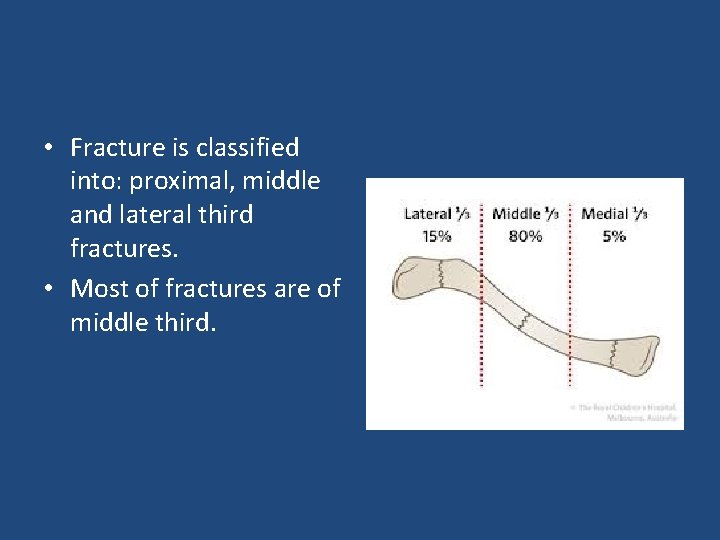  • Fracture is classified into: proximal, middle and lateral third fractures. • Most