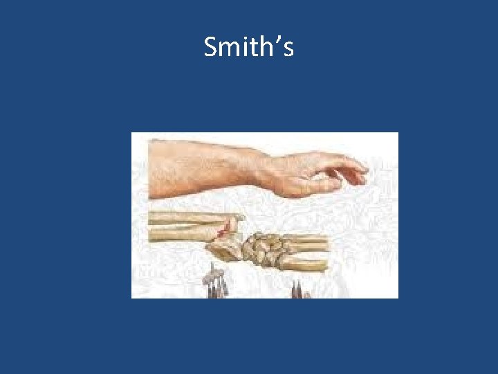 Smith’s 