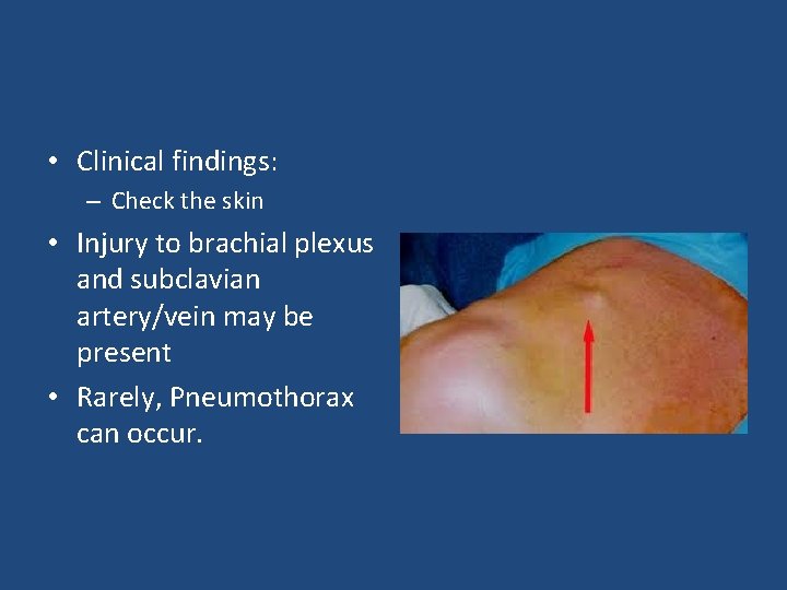  • Clinical findings: – Check the skin • Injury to brachial plexus and