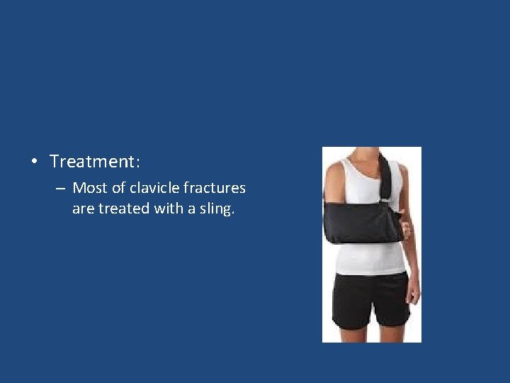  • Treatment: – Most of clavicle fractures are treated with a sling. 