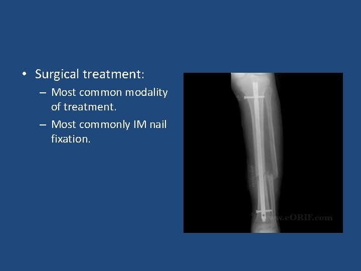  • Surgical treatment: – Most common modality of treatment. – Most commonly IM