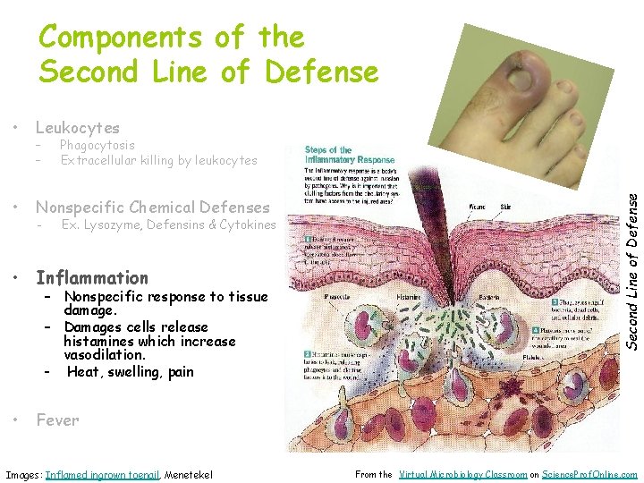 Components of the Second Line of Defense • Leukocytes • Nonspecific Chemical Defenses -